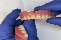 دندان سازی لبخند در یزد، بهترین دندان مصنوعی در یزد(دندان سازی)، ساخت تخصصی دندان مصنوعی ژله ای در یزد، ساخت باکیفیت ترین دندان های مصنوعی در یزد